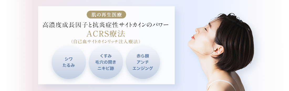 肌の再生医療 高濃度成長因子と抗炎症性サイトカインのパワー ACRS療法（自己血サイトカインリッチ注入療法）