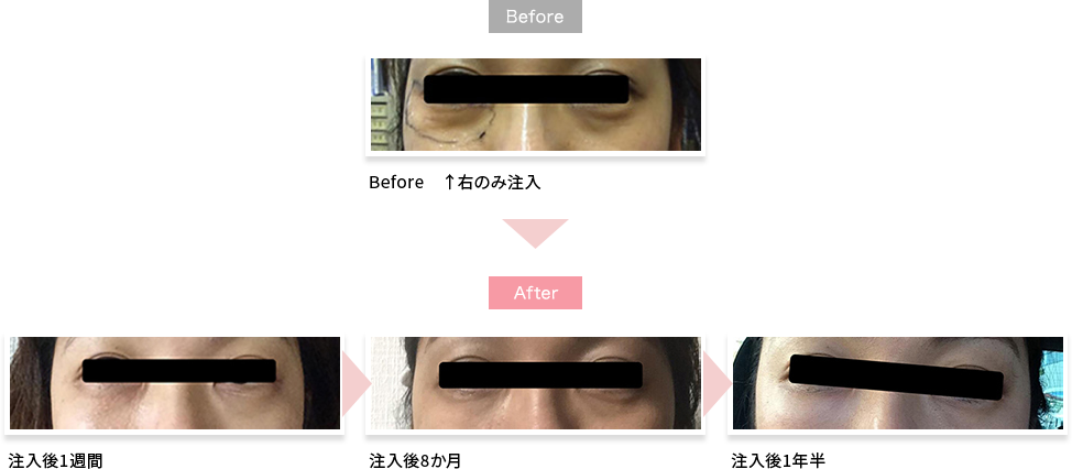 施術例2