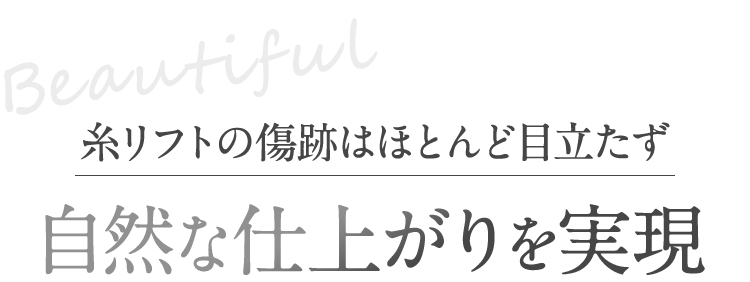 糸リフトの傷跡はほとんど目立たず自然な仕上がりを実現