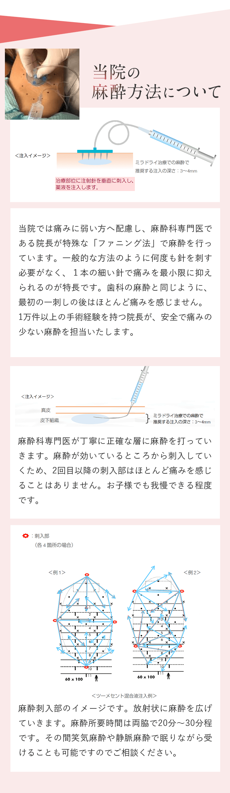 当院の麻酔方法について