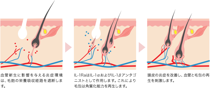薄毛治療でお悩みの方へ
