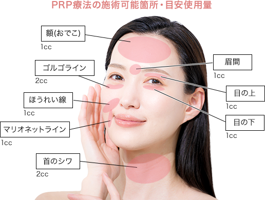 PRP療法の施術可能箇所・目安使用量